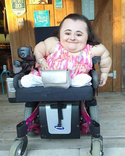 mercedes valentine|Influencer with rare illness goes from wheelchair to pole dancing